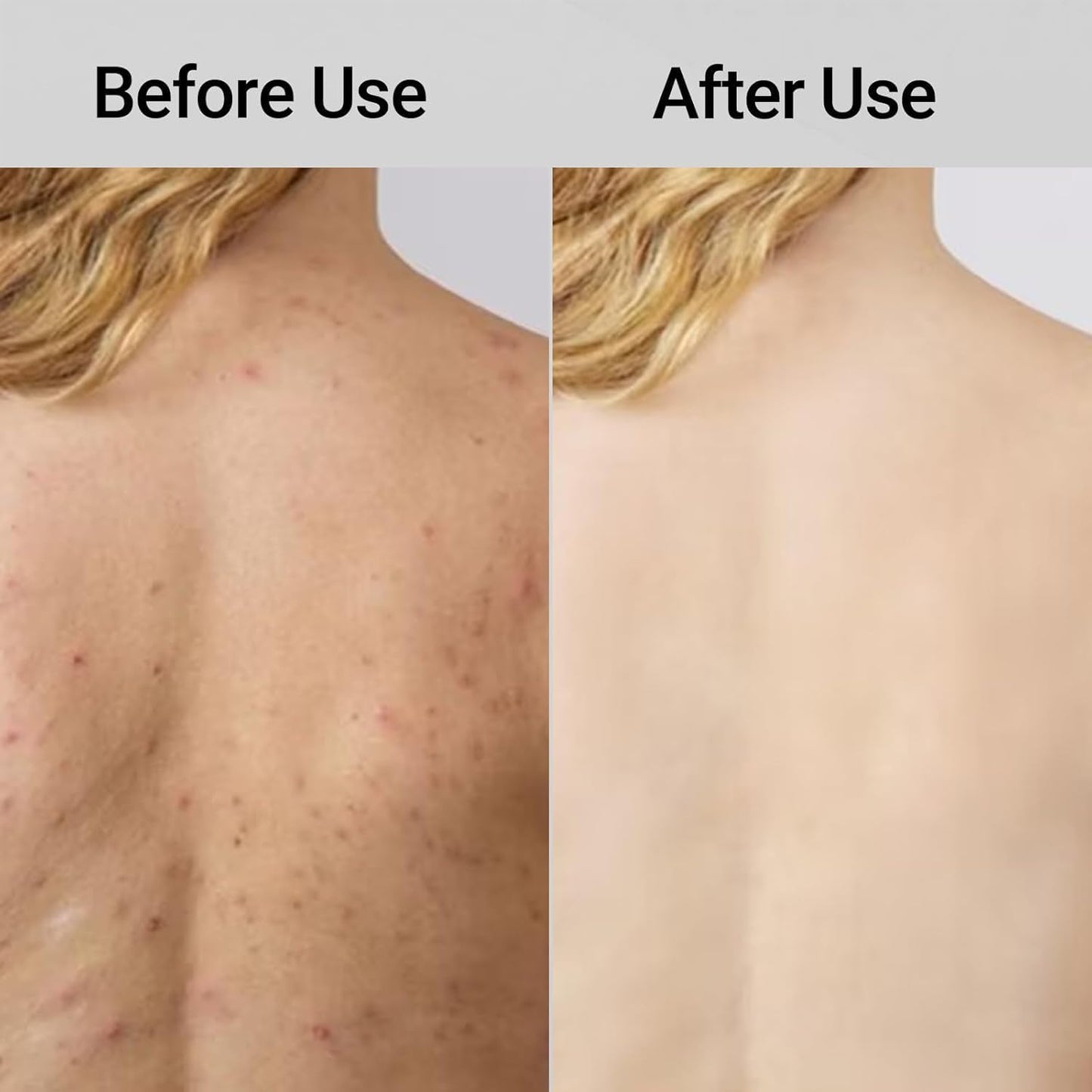 SkinFloss™ Exfoliating Shower Towel
